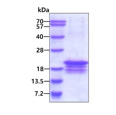 SDS-PAGE Recombinant Human DNA Polymerase epsilon subunit 3 His Protein